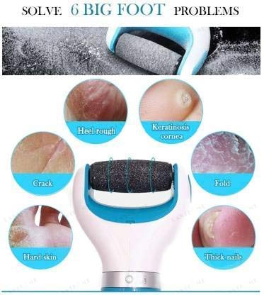 Electric Foot Callus Remover with 360° Rotating Roller, USB Rechargeable & Battery Operated with Washable Head for Cracked Heels, Hard Skin & Corn Removal