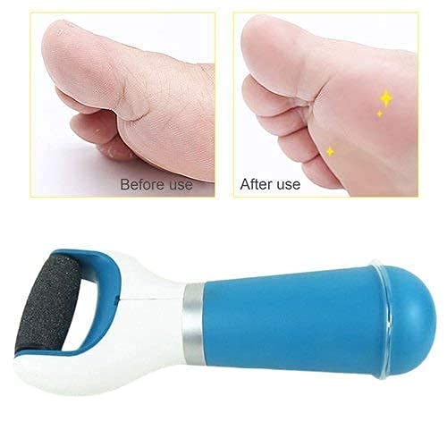 Electric Foot Callus Remover with 360° Rotating Roller, USB Rechargeable & Battery Operated with Washable Head for Cracked Heels, Hard Skin & Corn Removal
