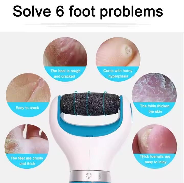 Electric Foot Callus Remover with 360° Rotating Roller, USB Rechargeable & Battery Operated with Washable Head for Cracked Heels, Hard Skin & Corn Removal