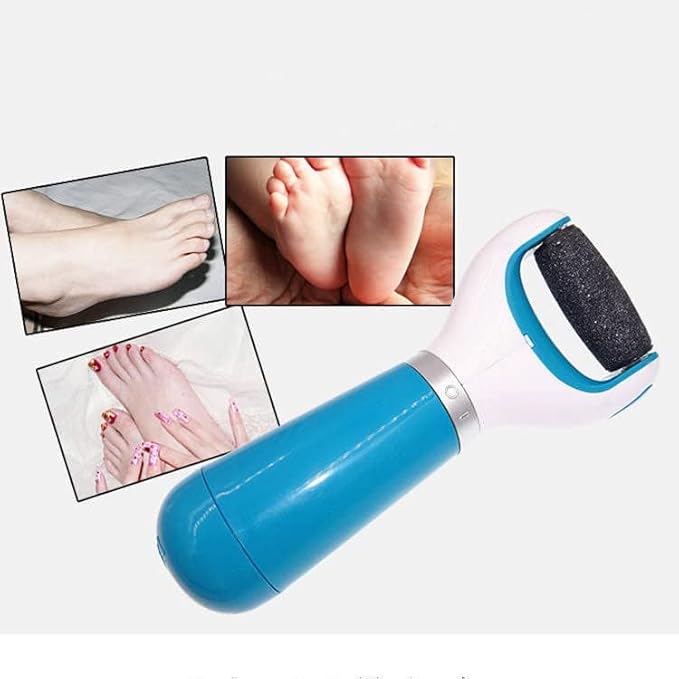 Electric Foot Callus Remover with 360° Rotating Roller, USB Rechargeable & Battery Operated with Washable Head for Cracked Heels, Hard Skin & Corn Removal