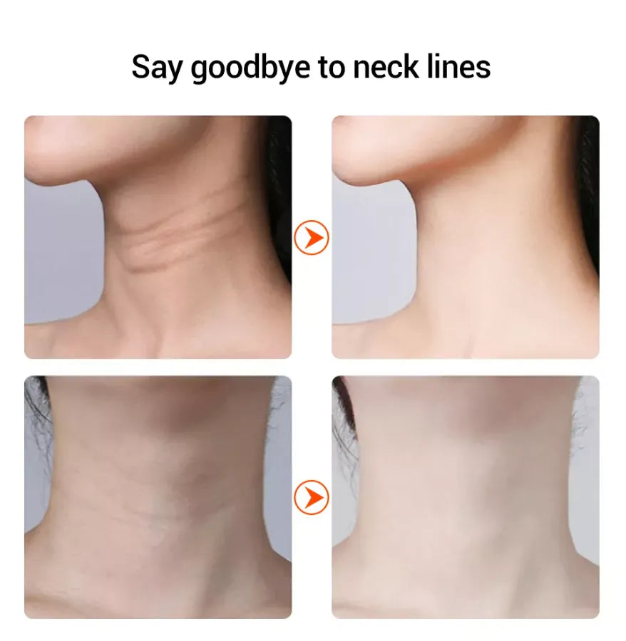 EMS Neck Skin Tightening & Face Lifting Beauty Therapy Massager - Anti Wrinkle & Rejuvenating